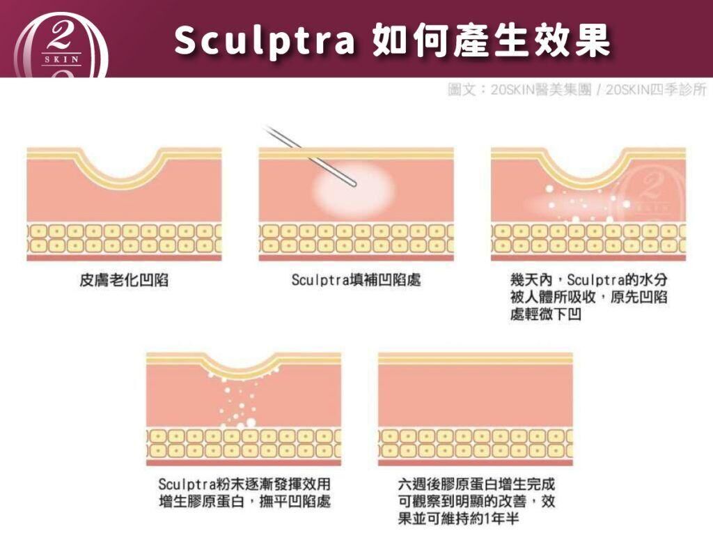 台中/二林四季皮膚科- 4D 童顏針是什麼？值得打嗎？價格、效果與常見疑問大公開！